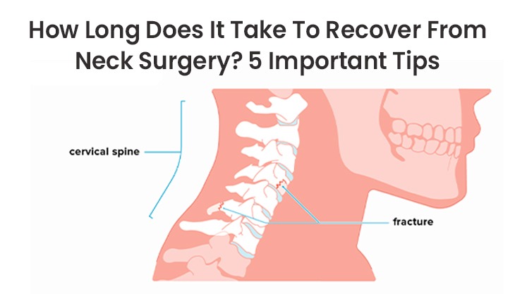 How Long Does It Take To Recover From Neck Surgery? 5 Important Tips