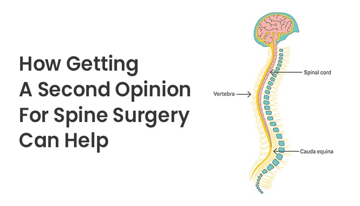 How Getting A Second Opinion For Spine Surgery Can Help