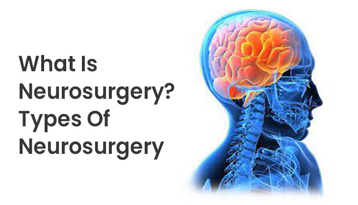 What Is Neurosurgery? Types Of Neurosurgery