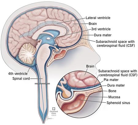 CSF-related pathology